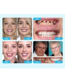 Декоративни изкуствени зъби Snap on Smile